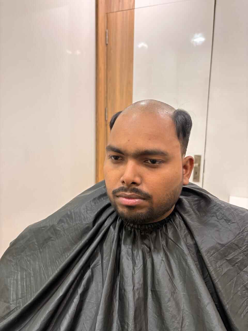 Before Treatment